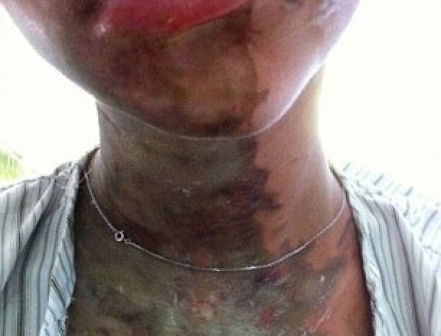 Θα του ξεριζώσουν τα μάτια και θα του κόψουν τη μύτη επειδή...