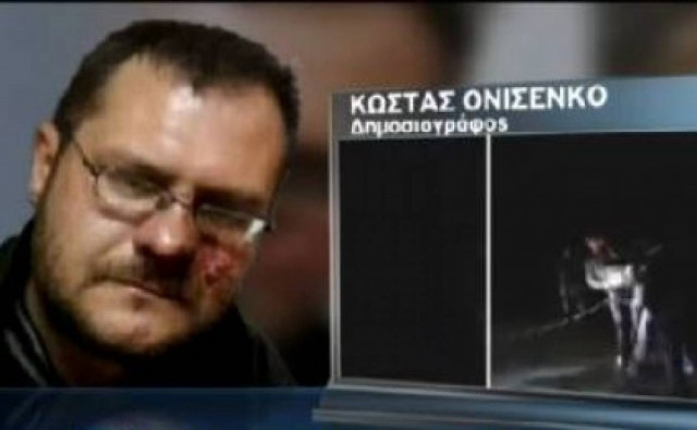 Κριμαία: Καρέ-καρέ η επίθεση στον Έλληνα δημοσιογράφο (βίντεο)