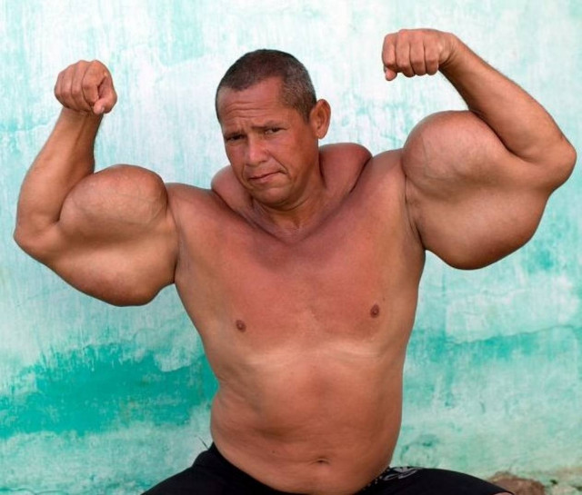 Ο βραζιλιάνος Ποπάι φλερτάρει με το θάνατο - Δείτε πώς έχει γίνει!