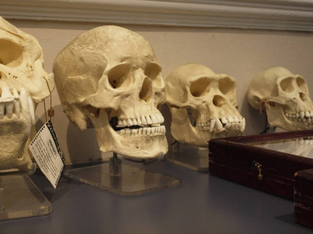 Δεν φαντάζεστε τι έκρυβε μέσα στο σάκο του