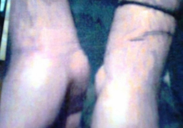 Φωτογραφίες-ΣΟΚ: Αστυνομικοί με βασάνιζαν στο τμήμα επί μιάμιση ώρα!