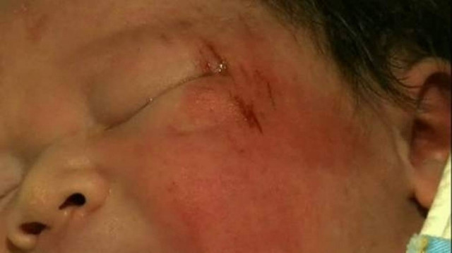 Γεννήθηκε στην άσφαλτο λίγο πριν ξεψυχήσει η μητέρα του (pic&vid)