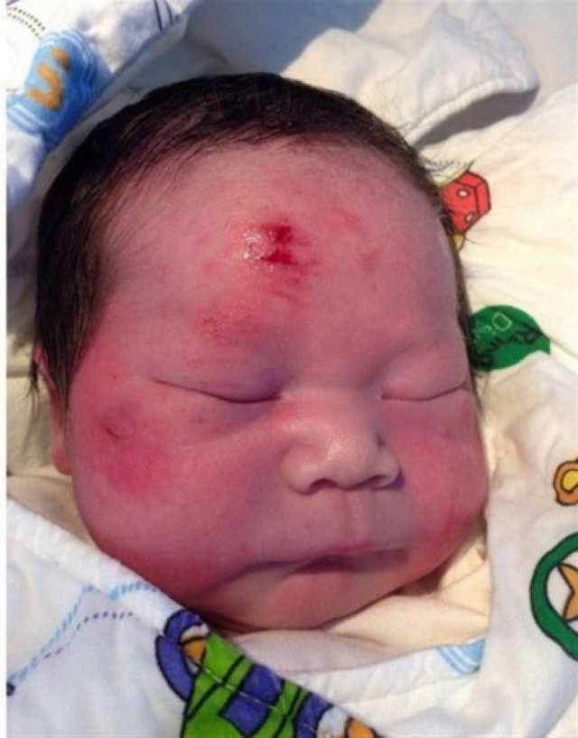 Μωρό γεννήθηκε λίγη ώρα αφότου η μητέρα του σκοτώθηκε σε τροχαίο