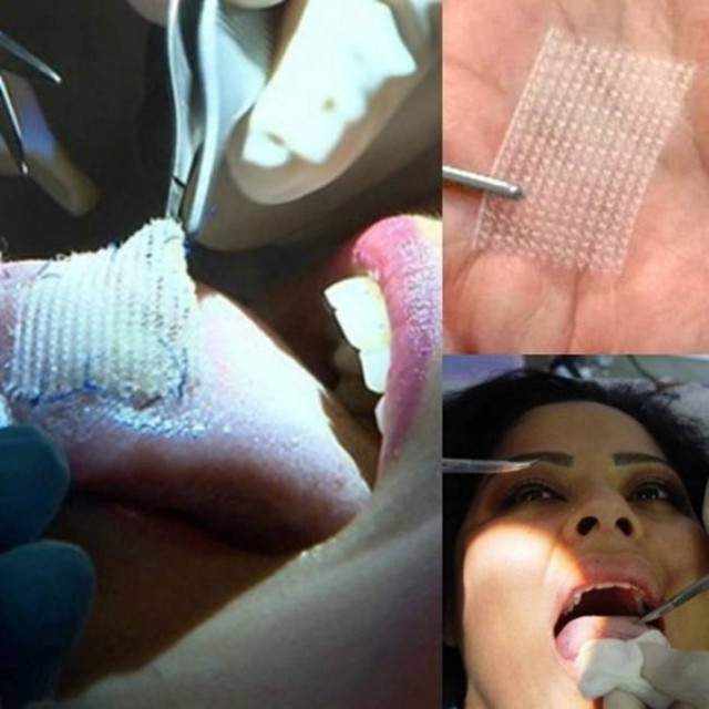 Πώς να χάσεις 30 κιλά σ’ ένα μήνα με μια νέα ακραία μέθοδο!