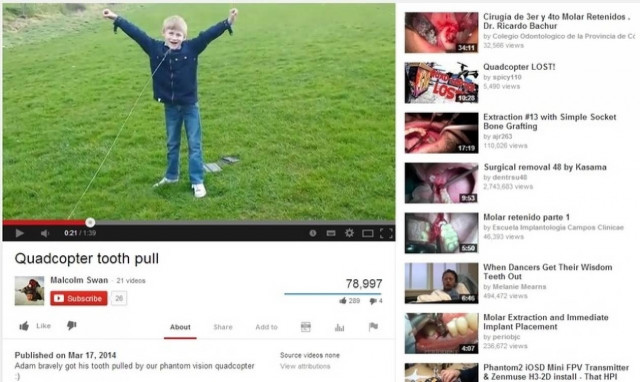 Πατέρας έβγαλε το δόντι του παιδιού του χρησιμοποιώντας... (βίντεο)