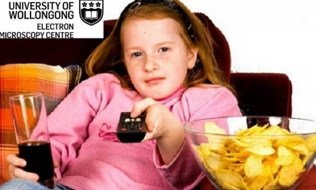 Έρευνα: Τι ευθύνεται για την παιδική παχυσαρκία