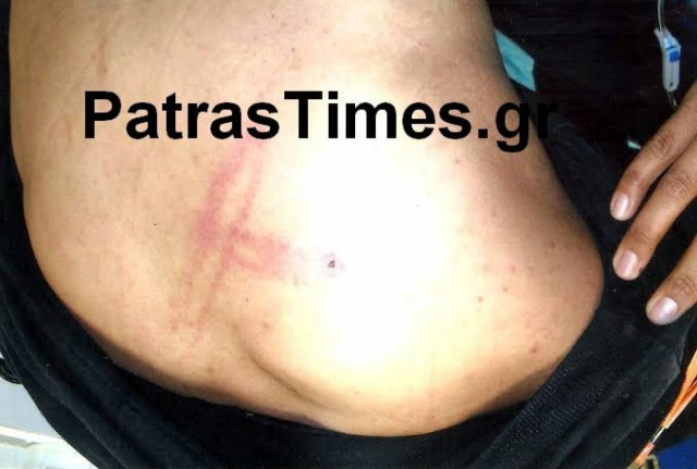 Νεαρός καταγγέλλει ξυλοδαρμό από αστυνομικούς (pics)