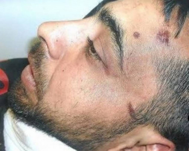 Πάτρα: 19 μήνες φυλάκιση στον νεαρό-Κατήγγειλε αστυνομικούς για βία