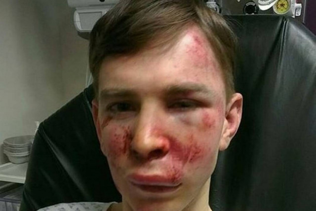 Στη φυλακή οι δράστες της φρικιαστικής επίθεσης σε παράλυτο