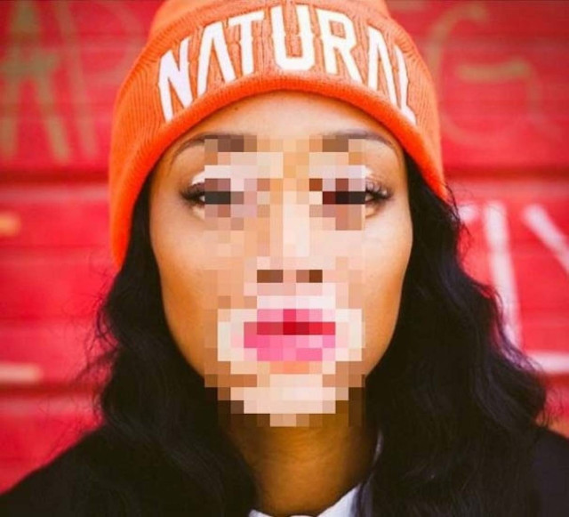 Winnie Harlow: Το μοντέλο που έκανε την πάθηση της, σπάνιο προσόν(pic)