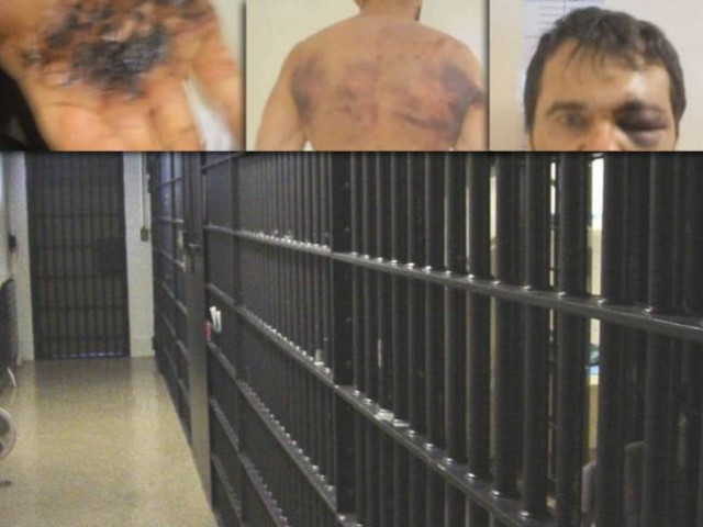 Τι έδειξαν τα αποτελέσματα της ιστολογικής για το θάνατο του Καρέλι