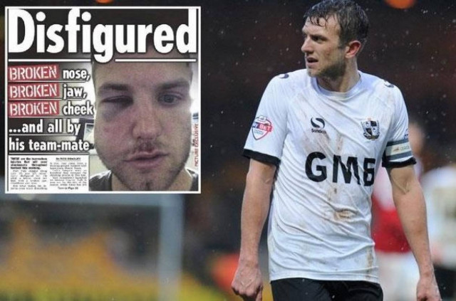 ΣΟΚ: Του έσπασε τη μυτη, το σαγόνι και το ζυγωματικό... στην προπόνηση