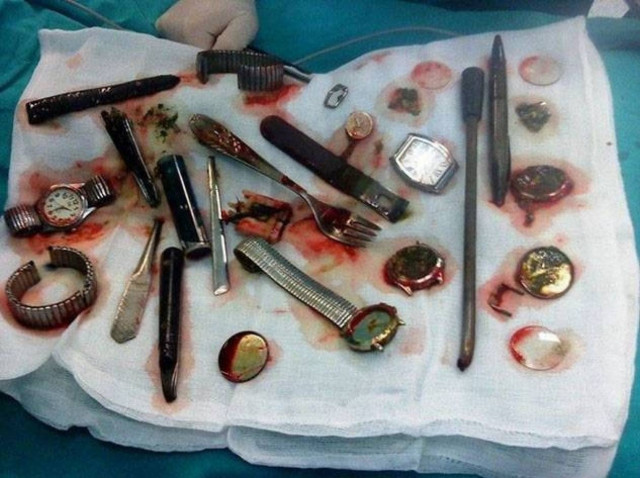 Διαρρήκτης κατάπιε τα κλοπιμαία. Και ήταν πολλά! (photo)