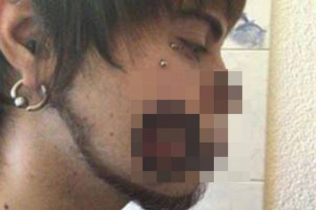 Σκληρές εικόνες: Γιατί να το κάνει αυτό κάποιος στον εαυτό του; (pic)