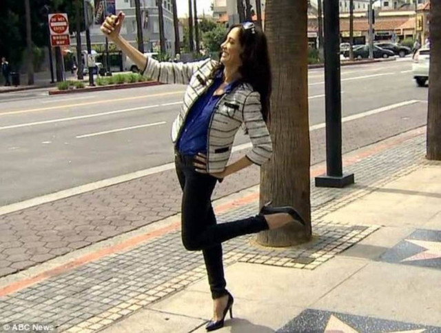 Ξόδεψε 15.000 δολάρια σε πλαστικές για να μοιάζει… (video+photos)