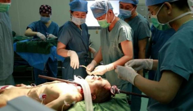 China: Steel rod pierced a builder’s skull! (photos)