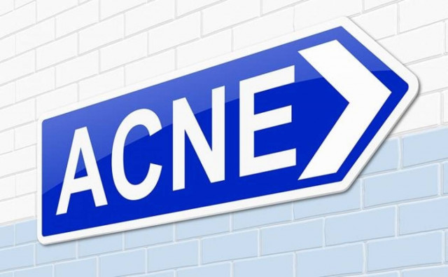 Τα λάθη που κάνετε και οδηγούν στην ακμή