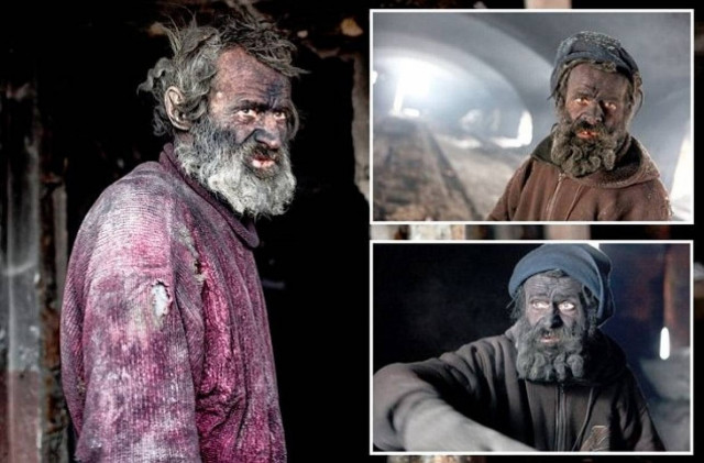 Η τραγική ιστορία του πιο βρώμικου ανθρώπου στην Ευρώπη (pics)