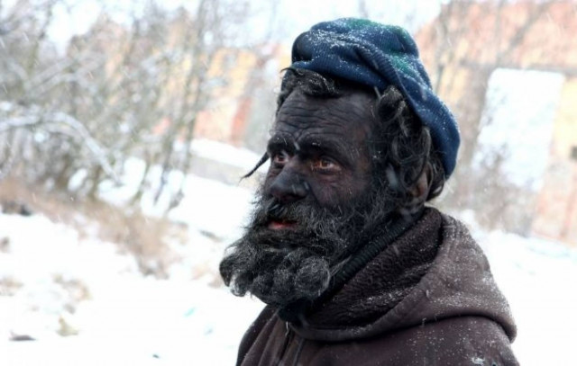 The tragic story of the dirtiest man in Europe (pics)