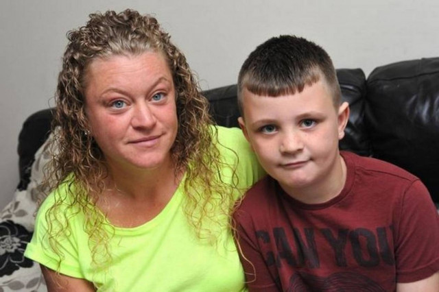 Κατάρα! Είναι αλλεργικός στον… εαυτό του! (photos)