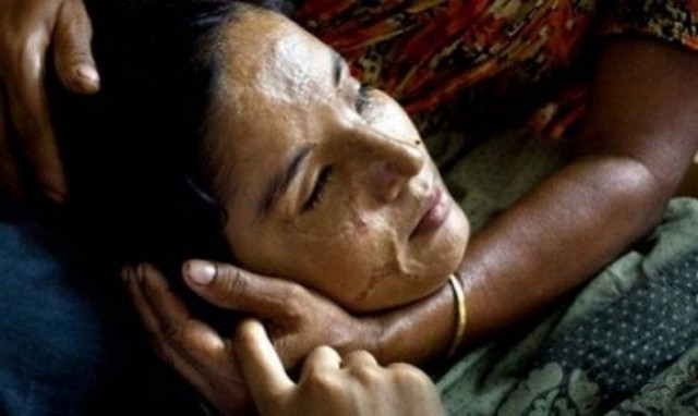 Φωτογραφίες γυναικών που τους επιτέθηκαν με βιτριόλι