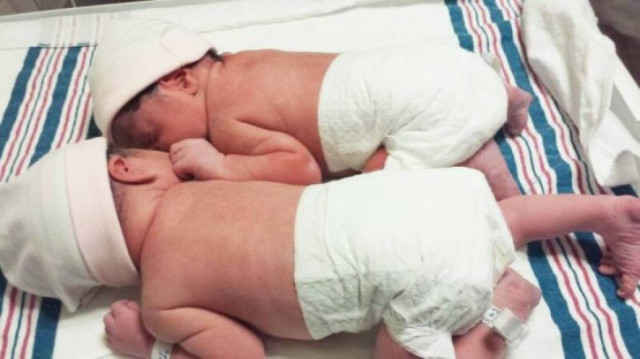 Το Μακάριο Νοσοκομείο διαψεύδει θέμα «εγγύησης» κράτησης διδύμων