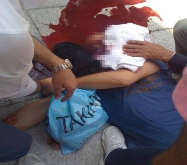 ΦΡΙΚΗ: Πυροβόλησαν διαδηλωτή στο κεφάλι–Η στιγμή της επίθεσης (vids)