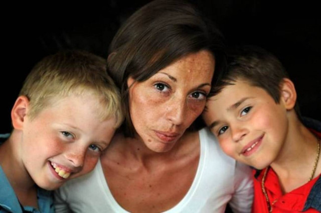 Μελλοθάνατη μητέρα μαζεύει χρήματα για οδοντίατρο αφού θέλει... (pics)