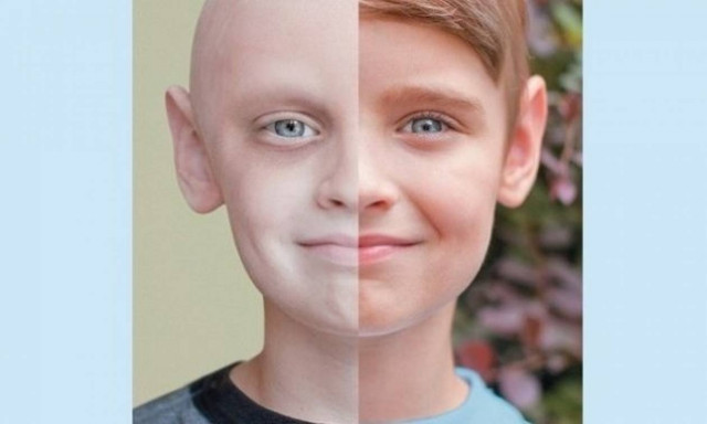 Η ζωή κέρδισε! Η ιστορία ενός αγοριού που δίνει ελπίδα στα άρρωστα παιδιά