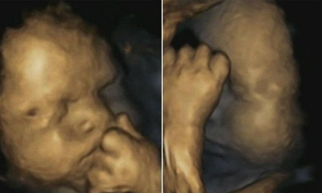 Τα αγέννητα μωρά νιώθουν το άγχος της μητέρας! (pics)