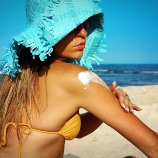 Απλοί τρόποι για να περιορίσετε το κάψιμο από τον ήλιο!