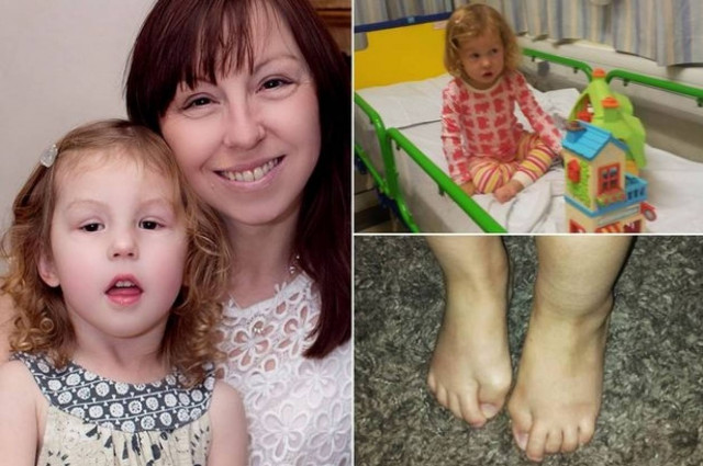 Σπάνια πάθηση μετατρέπει παιδί σε... άγαλμα! (pics)