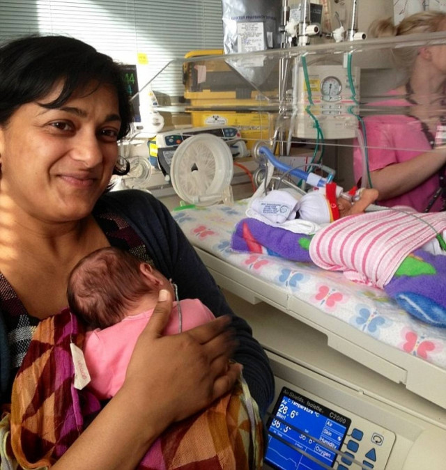 Χειρούργησαν δίδυμα που ήταν στον ίδιο πλακούντα! (pics)