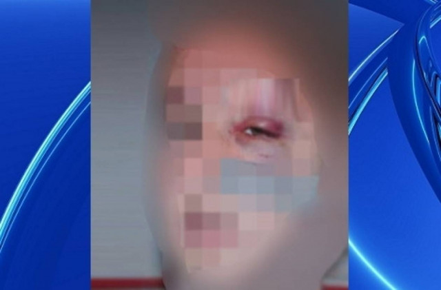 Ανήλικος ζήτησε πίσω τον αναπτήρα του και τον έστειλαν στο νοσοκομείο! (pic)