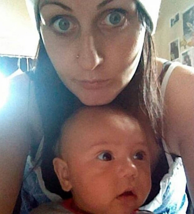 Πήγε για αφαίρεση ωοθηκών και… γέννησε