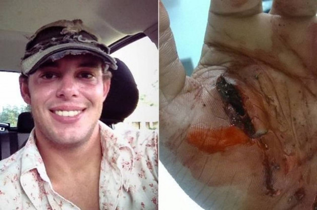 ΗΠΑ: Πήγε να σώσει αλιγάτορα και κατέληξε με 80 ράμματα! (video)