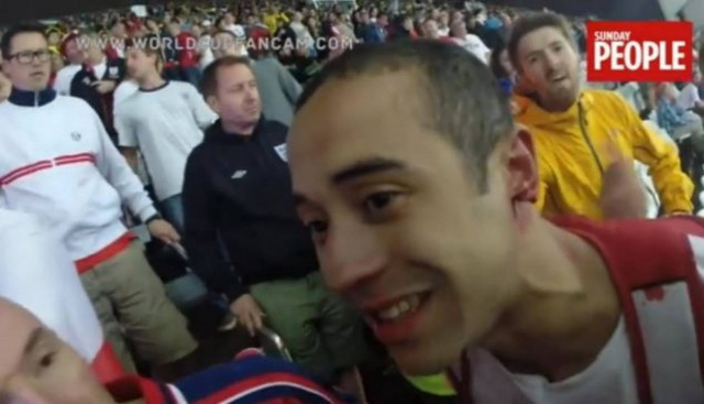 Μουντιάλ 2014: Έφαγαν το... αυτί φιλάθλου! (pics+video)