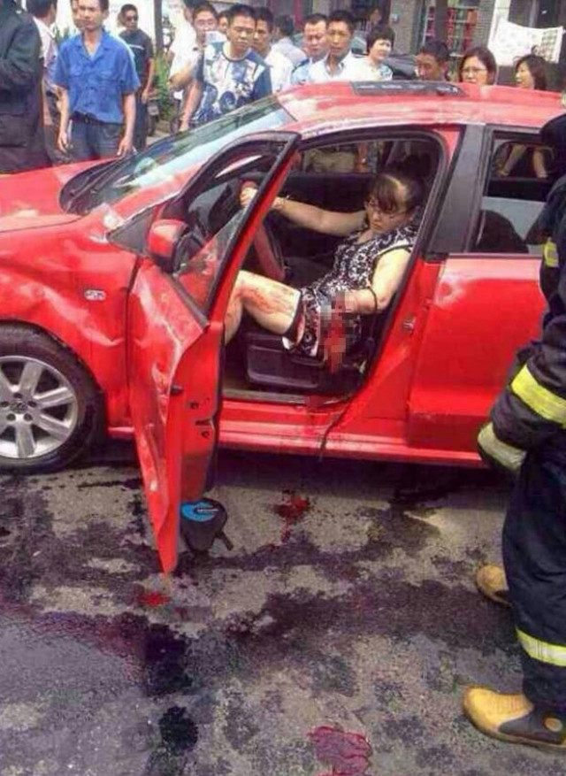 Προσοχή σκληρές εικόνες: Έχασε το χέρι της σε τροχαίο!