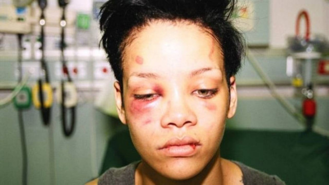 Προκλητικό tweet της Ριάνα για το Βραζιλία-Γερμανία