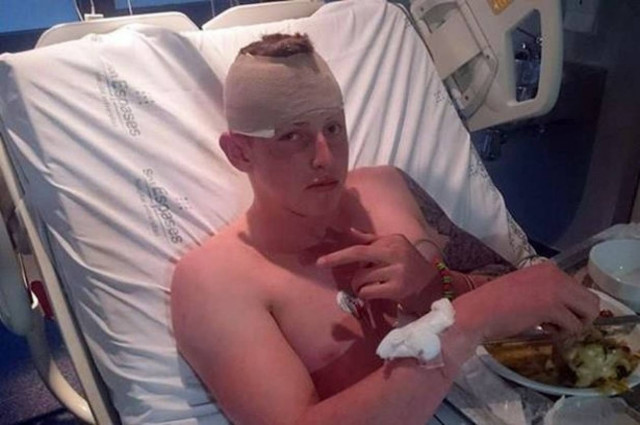 Υπνοβάτης έπεσε από τον τρίτο όροφο ξενοδοχείου!