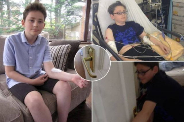 Φρικιαστικό ατύχημα: Το χέρι του πιάστηκε στο πόμολο! (photos)