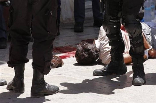 Χειρουργήθηκε ο Μαζιώτης