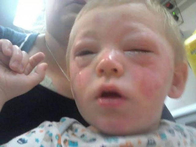 Μωρό ήρθε σε επαφή με κέτσαπ και δείτε πώς έγινε! (pics)