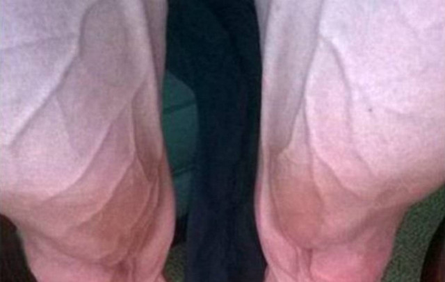 Σε ποιον αθλητή ανήκει αυτή η εικόνα;