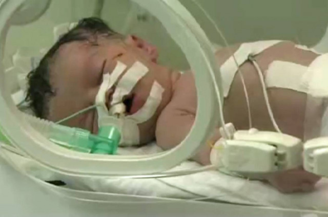 Το θαύμα της Γάζας: Κοριτσάκι ήρθε στον κόσμο μία ώρα μετά το θάνατο της μητέρας του