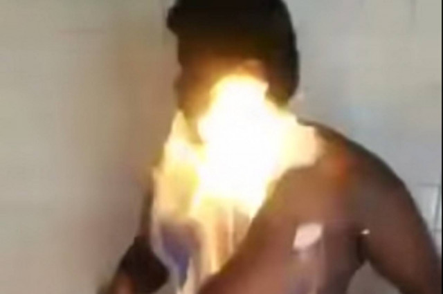 Αυτοπυρπόληση: Αυτή είναι η νέα μόδα των social medial! (vids+phs)