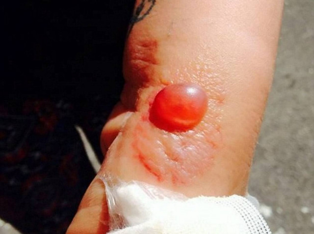 Δεν θα πιστεύετε τι της προκάλεσε αυτό το τσίμπημα (pics)