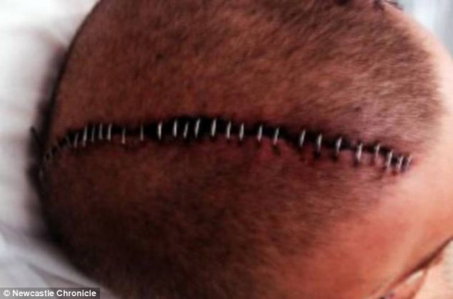 Μπλέχτηκε σε καυγά και έμεινε με μισό... κρανίο! (pics)