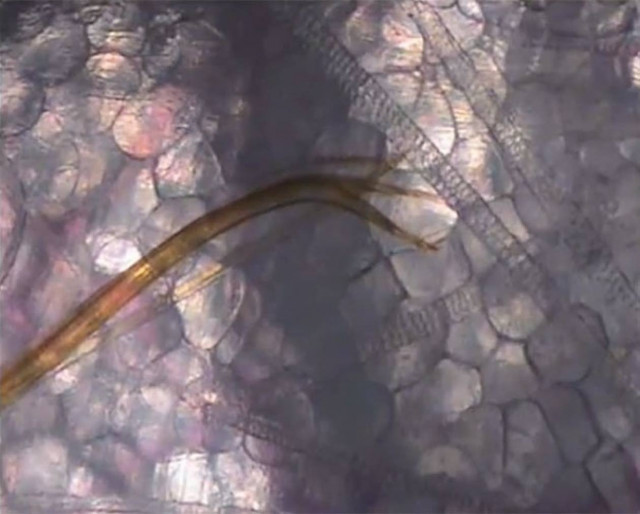 Τι κάνει το τσίμπημα του κουνουπιού μέσα στο σώμα μας (Video)