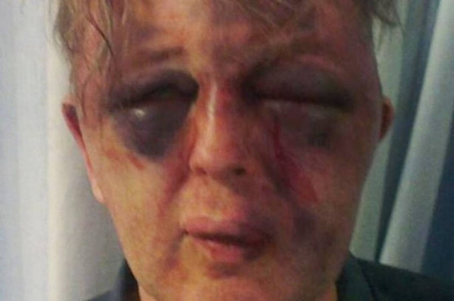 Τον μαύρισαν στο ξύλο γιατί τους αντιστάθηκε!